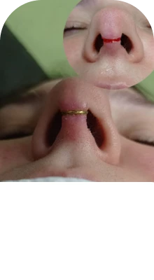 Manejo de intercorrências e complicações